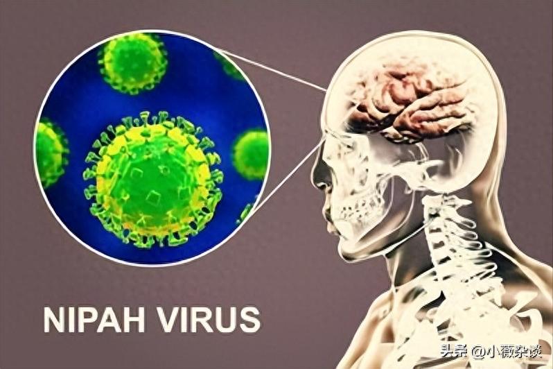 印度突发尼帕病毒疫情，致死率高且无药可治，危害远超新冠